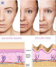 DA LÃO HÓA LÀ GÌ? VÀ BÍ KÍP CHỐNG LÃO HÓA, TRẺ HÓA DA SAU 4 TUẦN CÙNG PISTAR